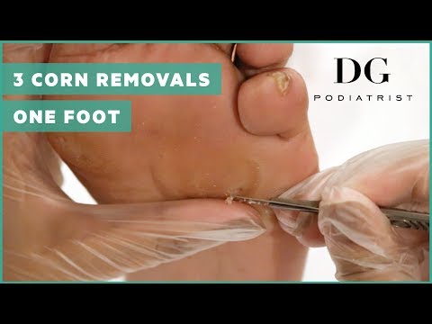 download lagu mp3 mp4 By The Foot, download lagu By The Foot gratis, unduh video klip By The Foot