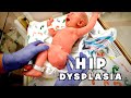 NEWBORN WITH CONGENITAL HIP DYSPLASIA Hospital Visit Dr Paul