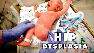 NEWBORN WITH CONGENITAL HIP DYSPLASIA (Hospital Visit) | Dr. Paul
