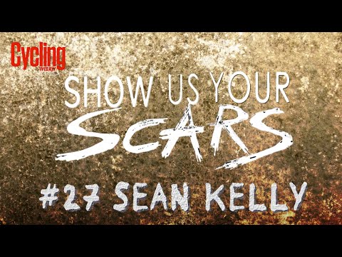 Show us your scars: Sean Kelly | Cycling Weekly