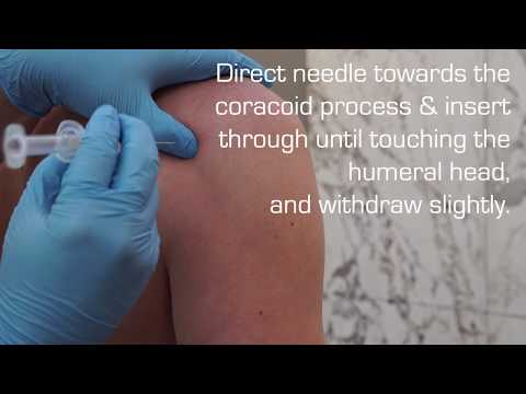 Injection Technique into the Glenohumeral Joint for OA or Adhesive Capsulitis