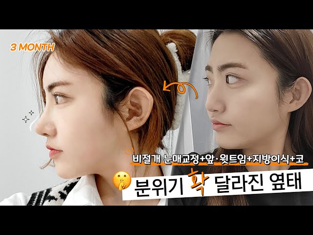 e쁨, 에픽성형외과 E쁨, 에픽성형외과