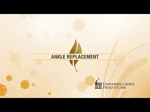 Ankle Replacement - Health at Iowa, Winter 2015