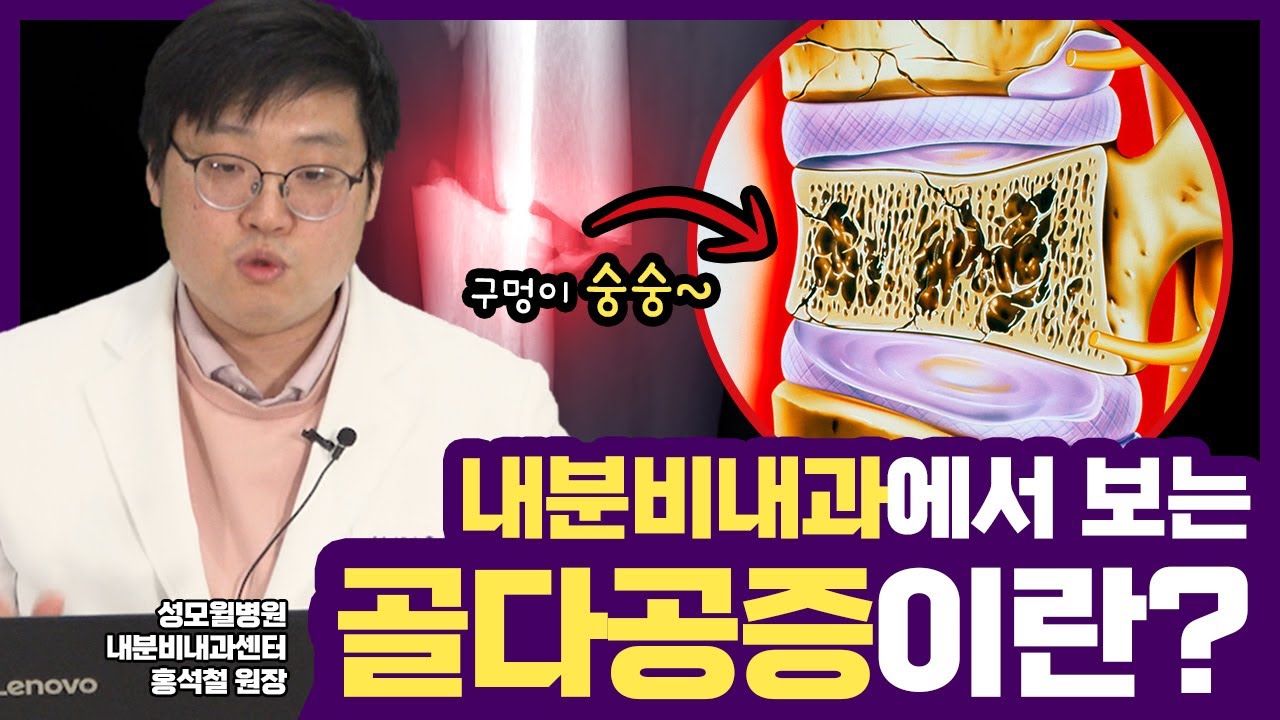 다 같은 골다공증이 아닙니다! #골다공증 Part 1 (성남 #성모윌병원) 썸네일 이미지