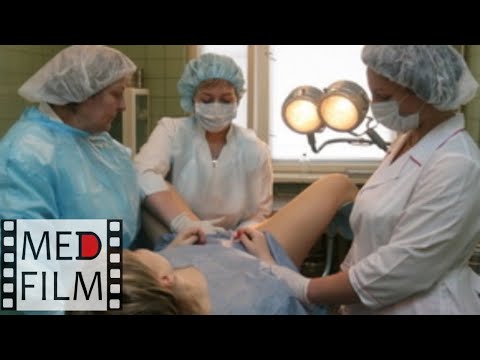 Осмотр первобеременной, схватки © Pain during childbirth, Analgesia