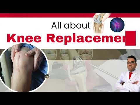 All About Knee Replacement | Dr. Ranvijay Pathak