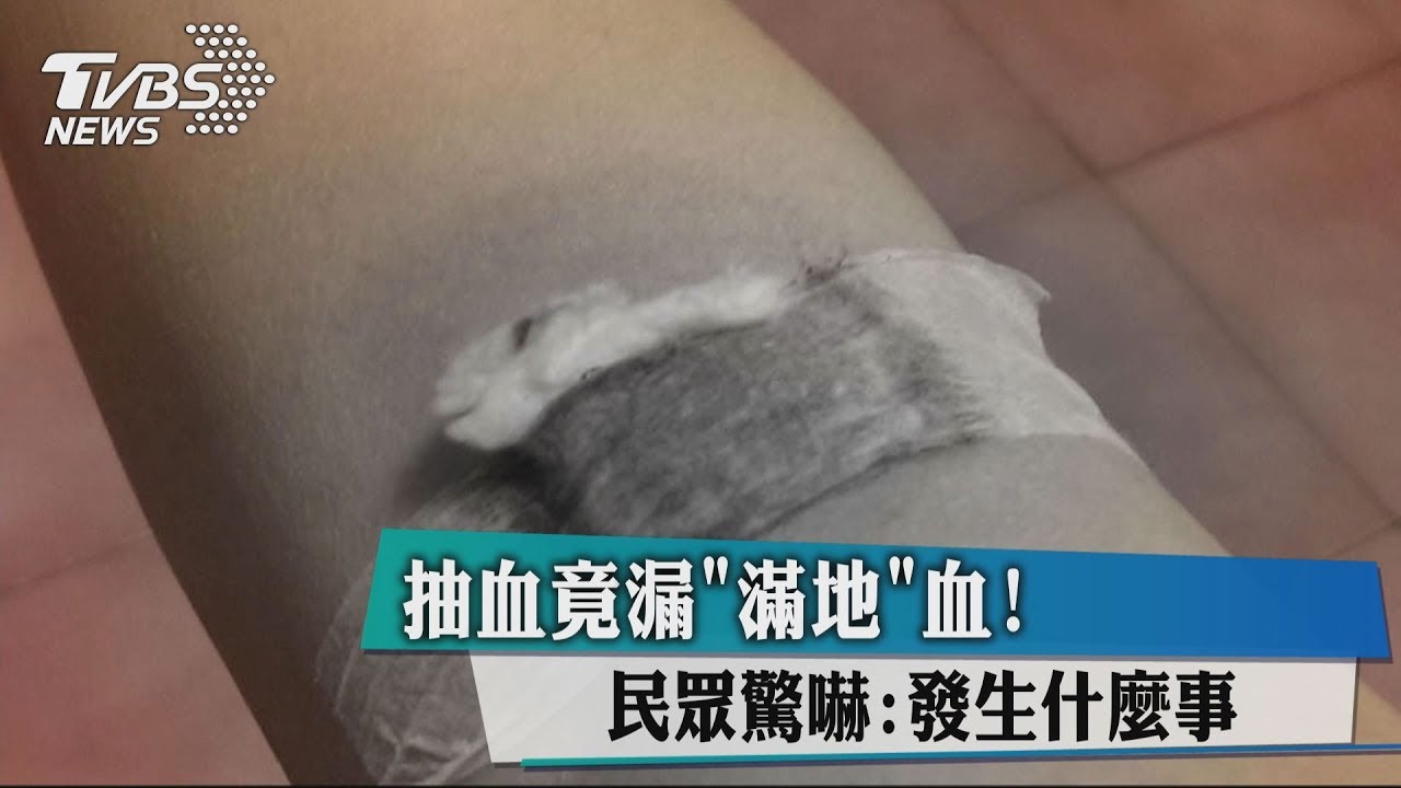 抽血竟漏滿地血! 民眾驚嚇:發生什麼事