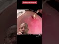 EXPLOSIVE ABSCESS Shorts