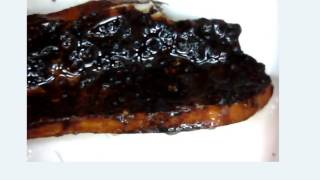 Morgellons Disease Is A Fungi, Shingles & lyme Disease Is Morgellons & The Cure