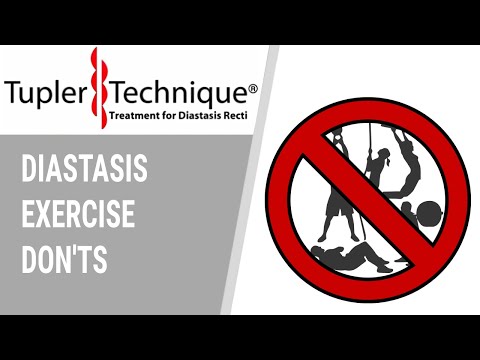 DIASTASIS EXERCISE DON'TS