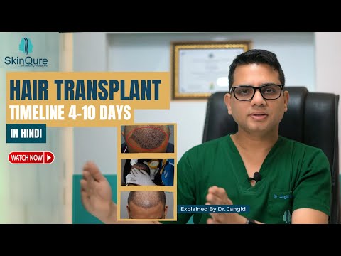 Hair Transplant Timeline 4 -10th day | Best Dermatologist and Hair Transplant Surgeon in Delhi