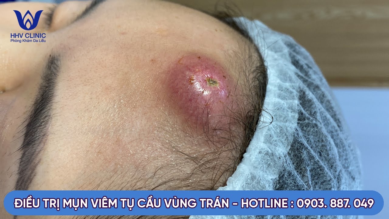 YouTube Thumbnail Downloader FULL HQ IMAGE