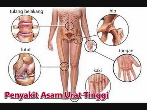 Apa yang akan terjadi jika setelah anggota besar akan memasuki kecil Kenari dan madu dari impotensi