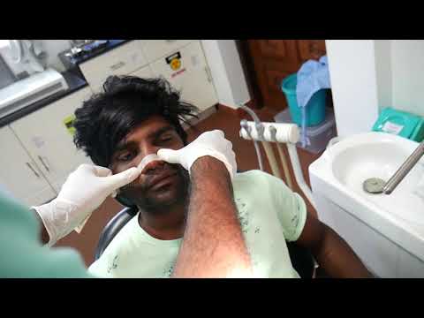 Rhinoplasty Surgery