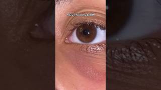 Crying a lot can also cause puffy eyes and dark circles! #crying