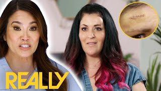 Woman Wants Dr. Lee To Pop A Bump On Her Forehead Without Leaving A Big Scar | Dr. Pimple Popper
