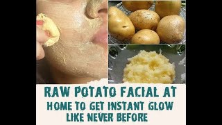 Potato Mask || Get Rid Of Pimples And Pores || Get Rid Of Dark Circles