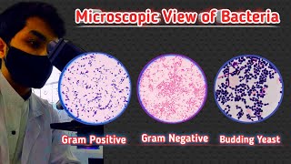 Gram positive and Gram negative bacteria | gram staining microscopic view | GPC, GNB, BYC, GPB, GNC