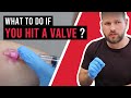 What to do if you hit a valve. - IV cannulation Tips and Tricks