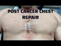 They Got Rid of ALL the Cancer - THE COMEBACK BEGINS!