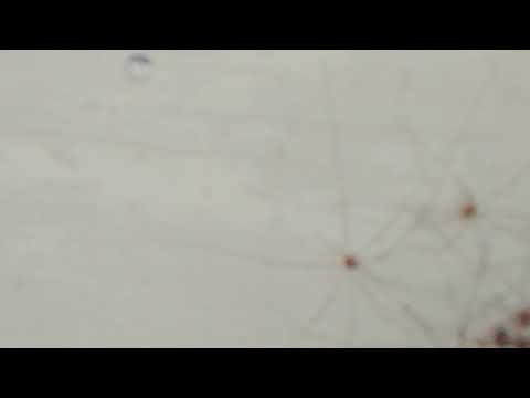 Daddy long-legs cluster