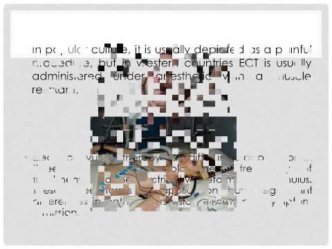 2 Electroconvulsive therapy