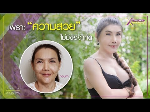 Exciter ที่แข็งแกร่งสำหรับผู้หญิง อายุเฉลี่ยของการโจมตีของความอ่อนแอ