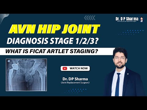 Diagnosis of AVN Hip X-ray/MRI Stage 1/2/3? Ficat and Artlet Classification & Treatment In Delhi NCR