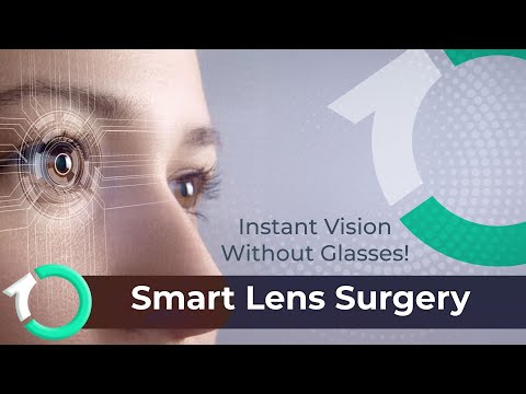 Trifocal Smart Lens Implantation - Surgical Procedure - One Clinic Patient Review Video