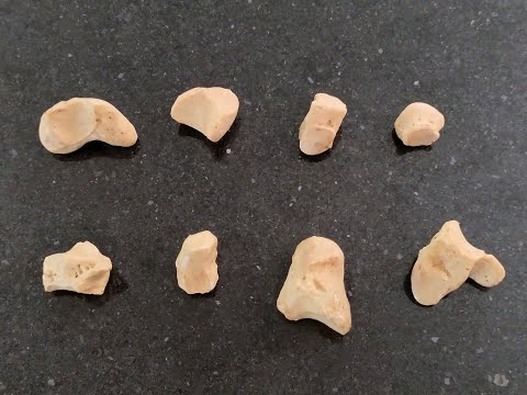 Carpal Bones - Identification