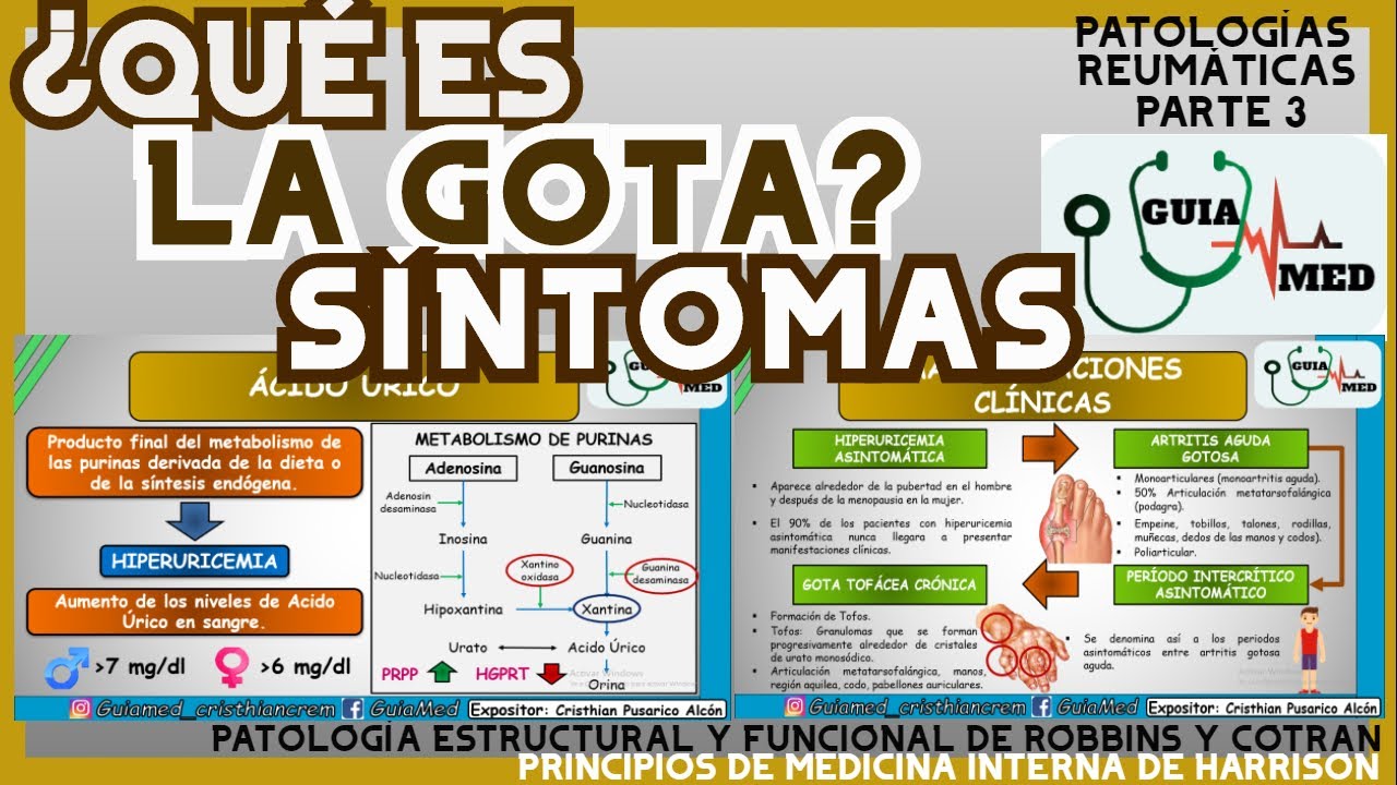 QUE ES LA GOTA Y CUALES SON LOS SÍNTOMAS | GuiaMed
