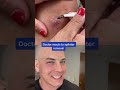 Derm reacts to MASSIVE splinter! #tree #splinter #dermreacts #doctor