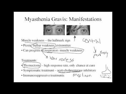 Neurologische Pathophysiologie: Schmerz, Myasthenia gravis, Guillain-Barré-Syndrom