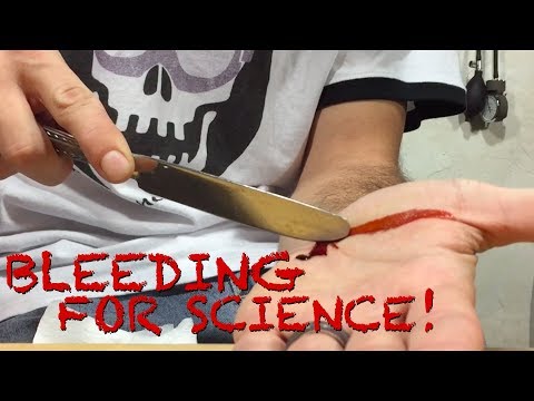 Cutting Myself for Science!  Cool Blood Experiment!