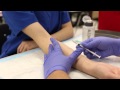 How To Do An Intradermal Injection