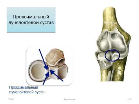 Действие магнитотерапии на суставы Как лежать при остеохондрозе позвоночника