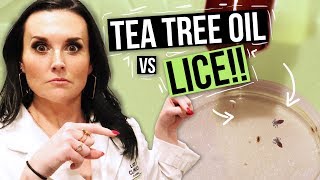 Removing LICE with TEA TREE OIL? - Watch this Before You Try!