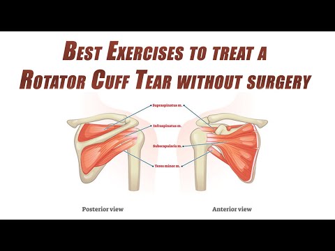 Best Self-Treatment of a Rotator Cuff Tear | Shoulder Rehab without Surgery