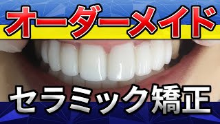 《セラミック矯正》オーダーメイドの秘密！技工士さんに急遽参加サムネイル