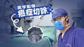 [問卦] 醫療機器人還要多久才普及