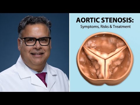 Aortic Valve Stenosis: Symptoms, Risks & Treatment