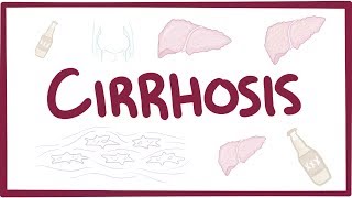 Download Lagu Cirrhosis - causes, symptoms, diagnosis, treatment, pathology Thumbnail