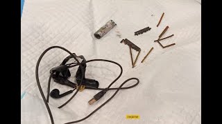 Foregin Body Hand Free ,match stick ,Battery cell, Blade removed to Esophagus by Endoscopy in SIAG