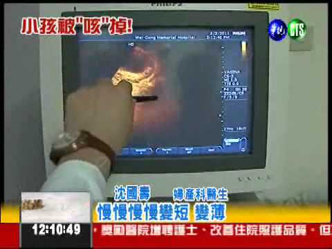 感冒咳2週! 懷胎4月竟流產