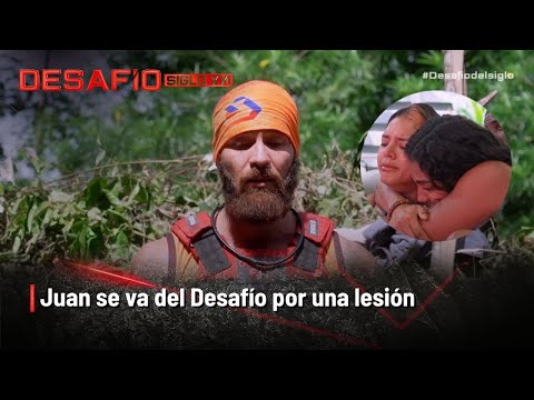 Juan se va del Desafío por una lesión y llega su reemplazo: ¿quién es? | Desafío del Siglo