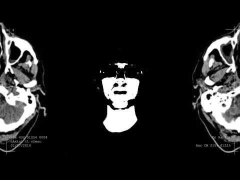 KVN - J'aurais dû t'oublier