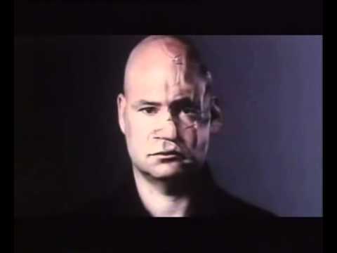 Crumpled Face Man Gets Repaired (UK) (2003)