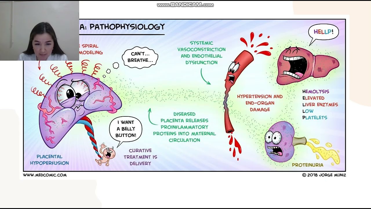 Akusherlikda gipertenziv buzilishlar