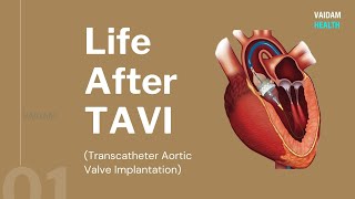 Life After TAVI