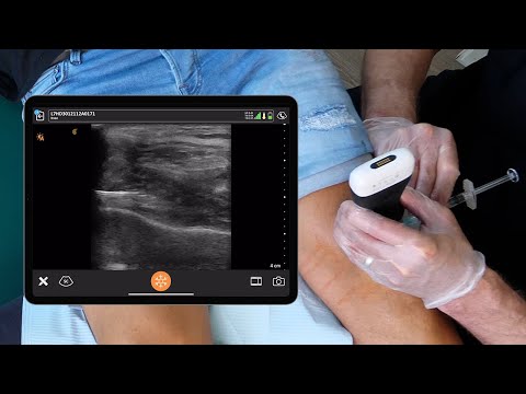 Halonix One Injection